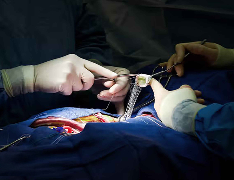Cardiología y Cirugía Cardíaca